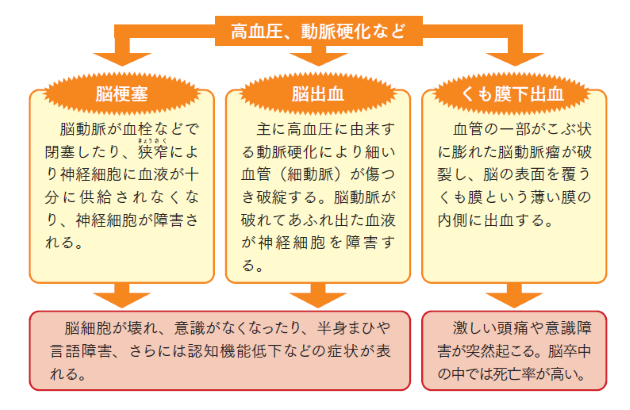 高血圧と脳卒中｜Next Stage｜三越伊勢丹健康保険組合